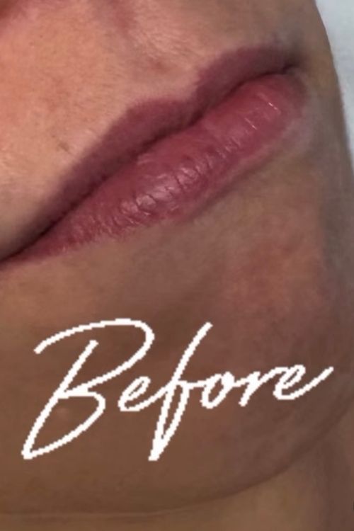 Lip Booster