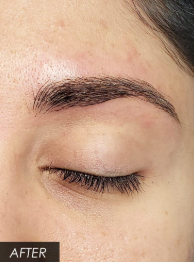 Microblading After
